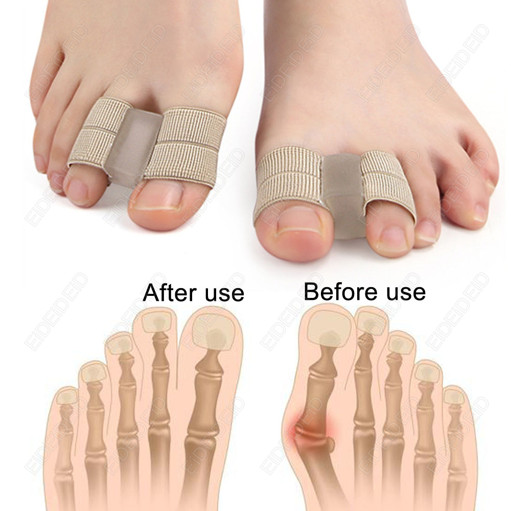 Bunion toe Corrector Orthotics - огляд і ціна Women'S Shoes With Bunions